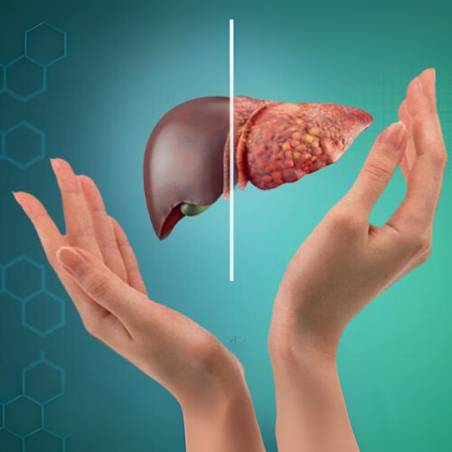 Fatty Liver Aid